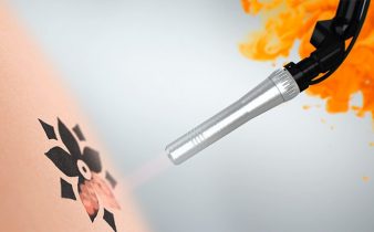 Asclepion PicoStar